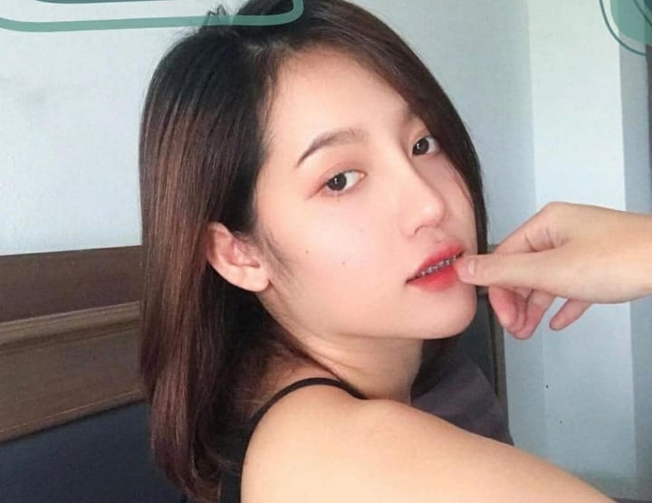 เสริมจมูก เชียงใหม่ รูปแบบ Open Rhinoplasty