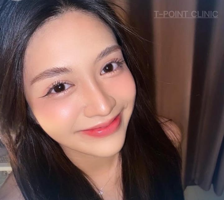 สาระน่ารู้ของการเสริมจมูก เชียงใหม่